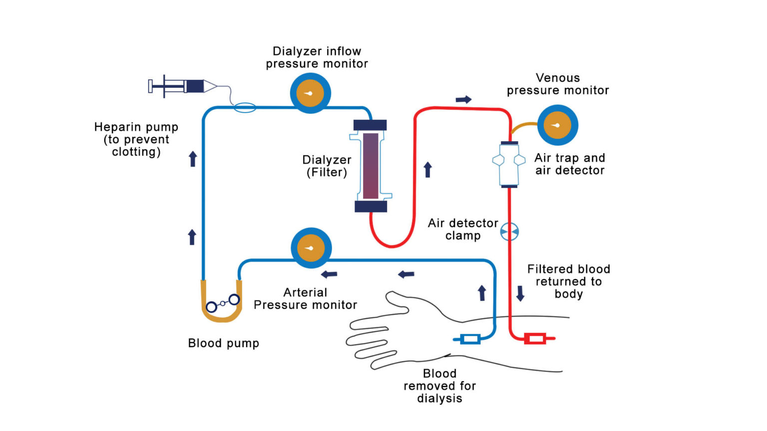 Haemodialysis NutritionFact.in