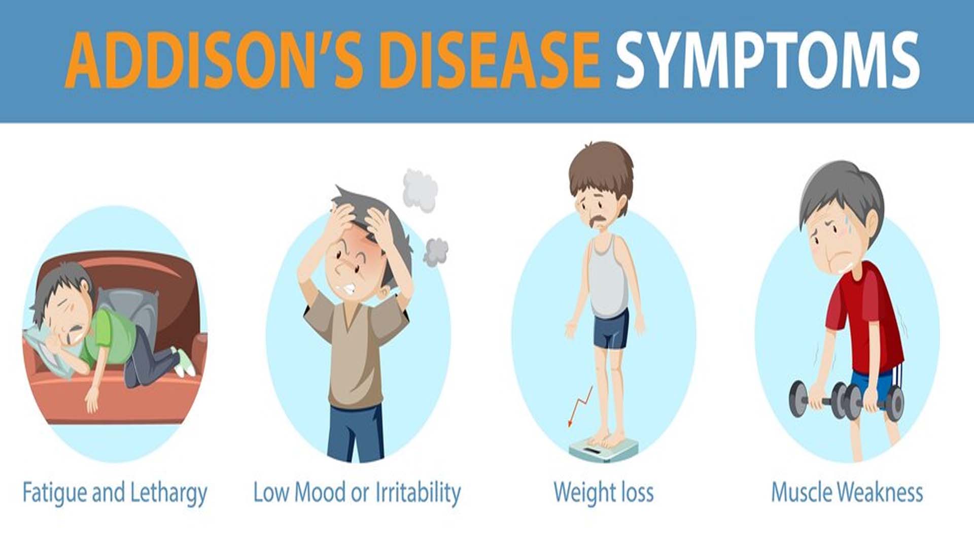 Addison's Disease: Symptoms, Causes, Diagnosis and Treatment