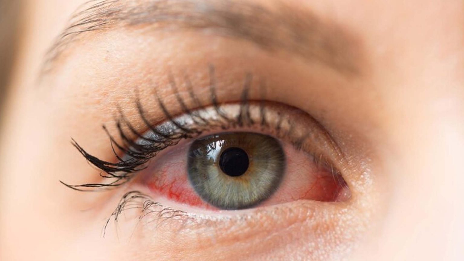 Graves’ Disease Symptoms, Causes, Diagnosis and Treatment