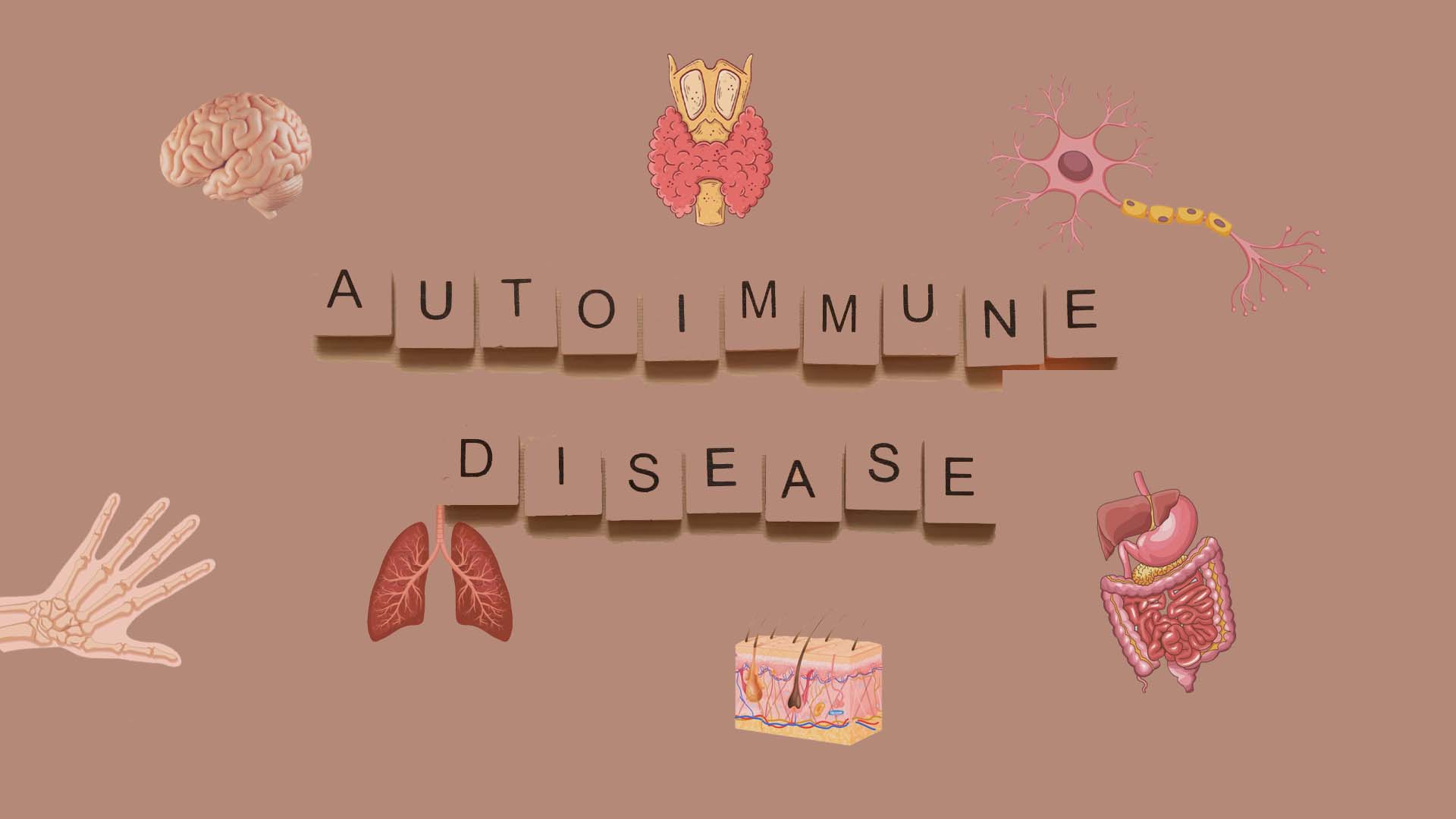 15 common Autoimmune diseases