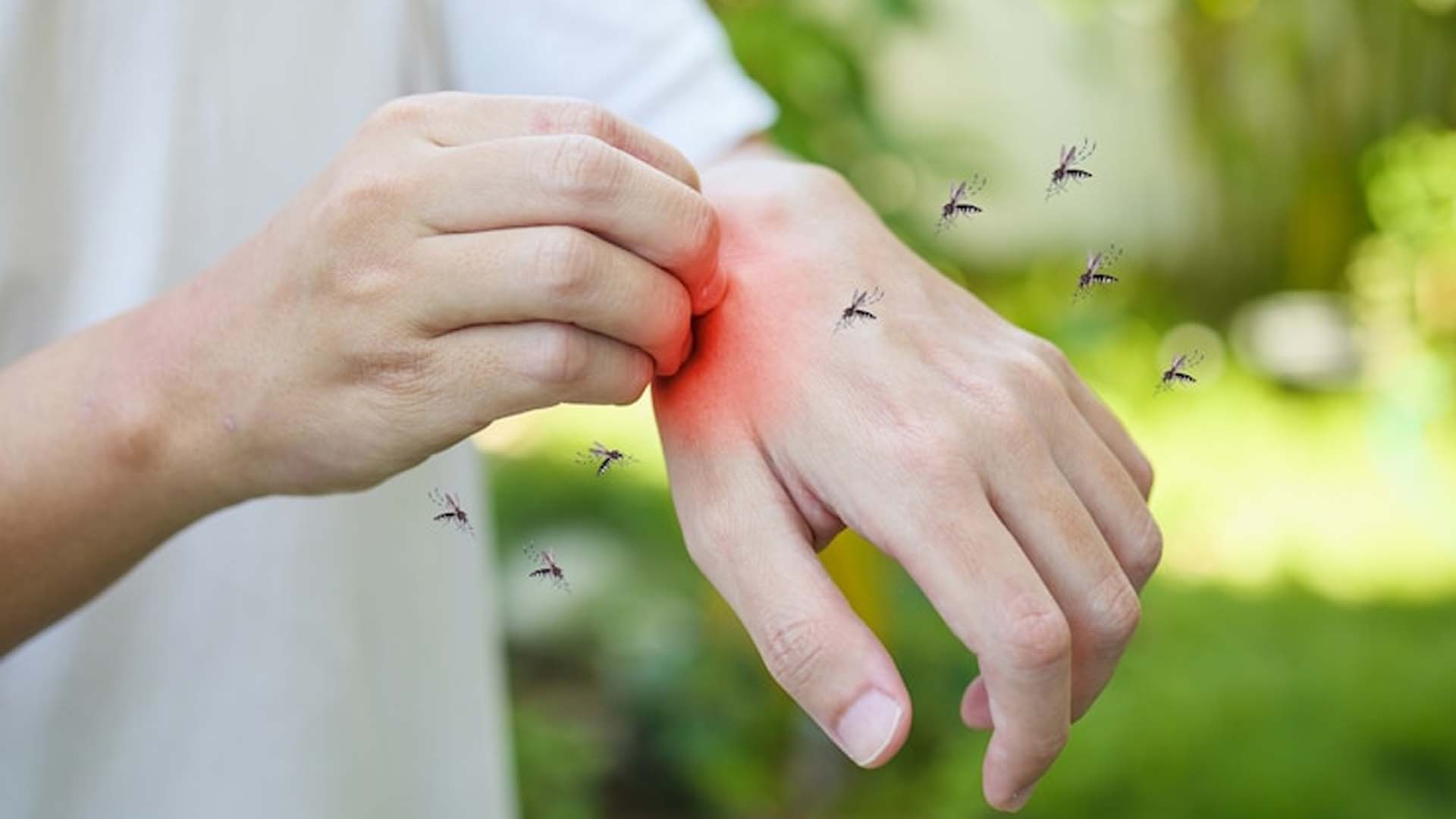 Dengue: Types, Causes, Symptoms, Diagnosis, Treatment and Diet