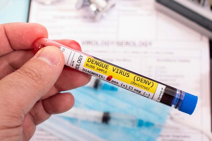 Dengue Virus Blood sample