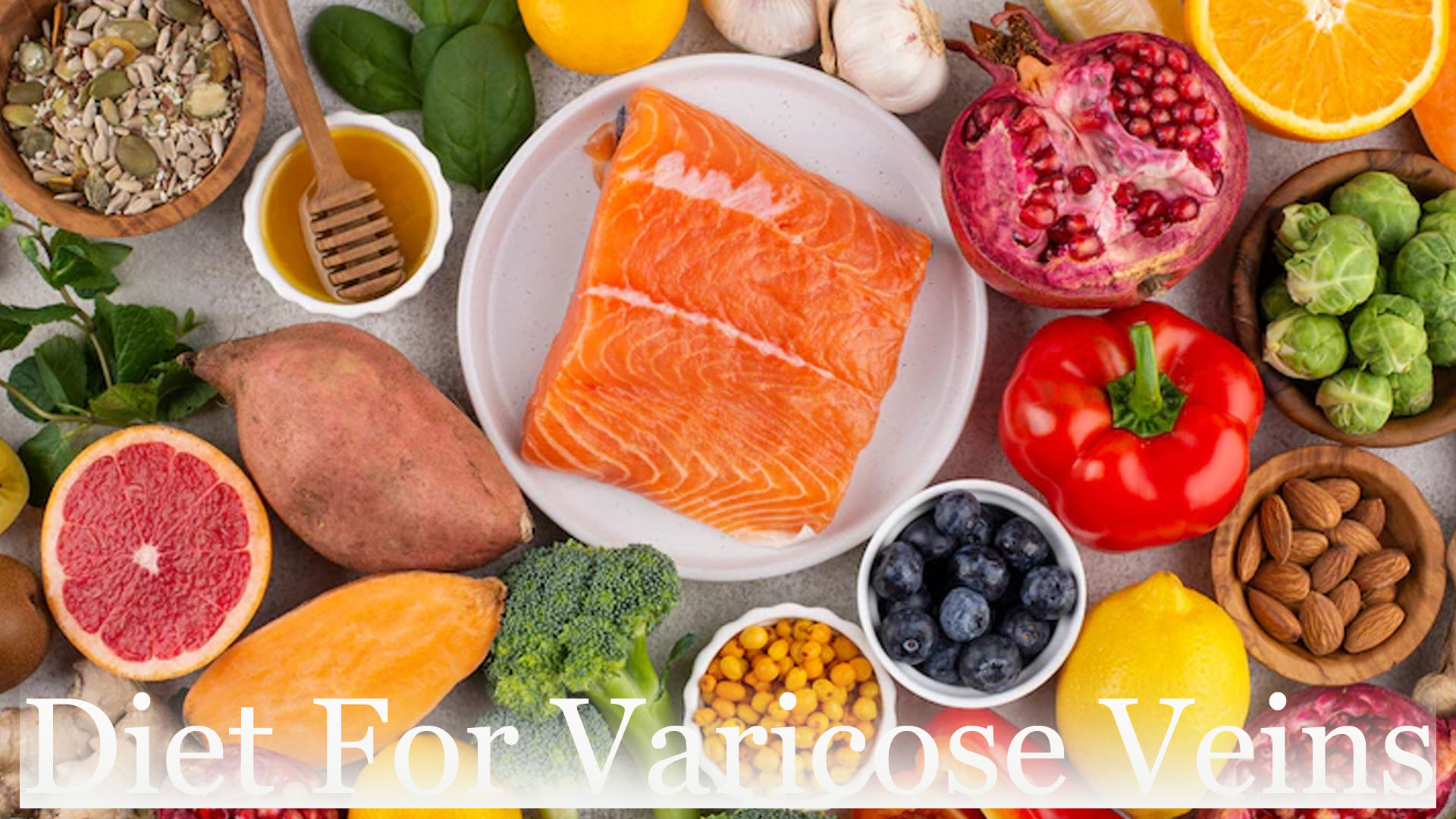 Varicose Veins: Best Foods and Worst Foods