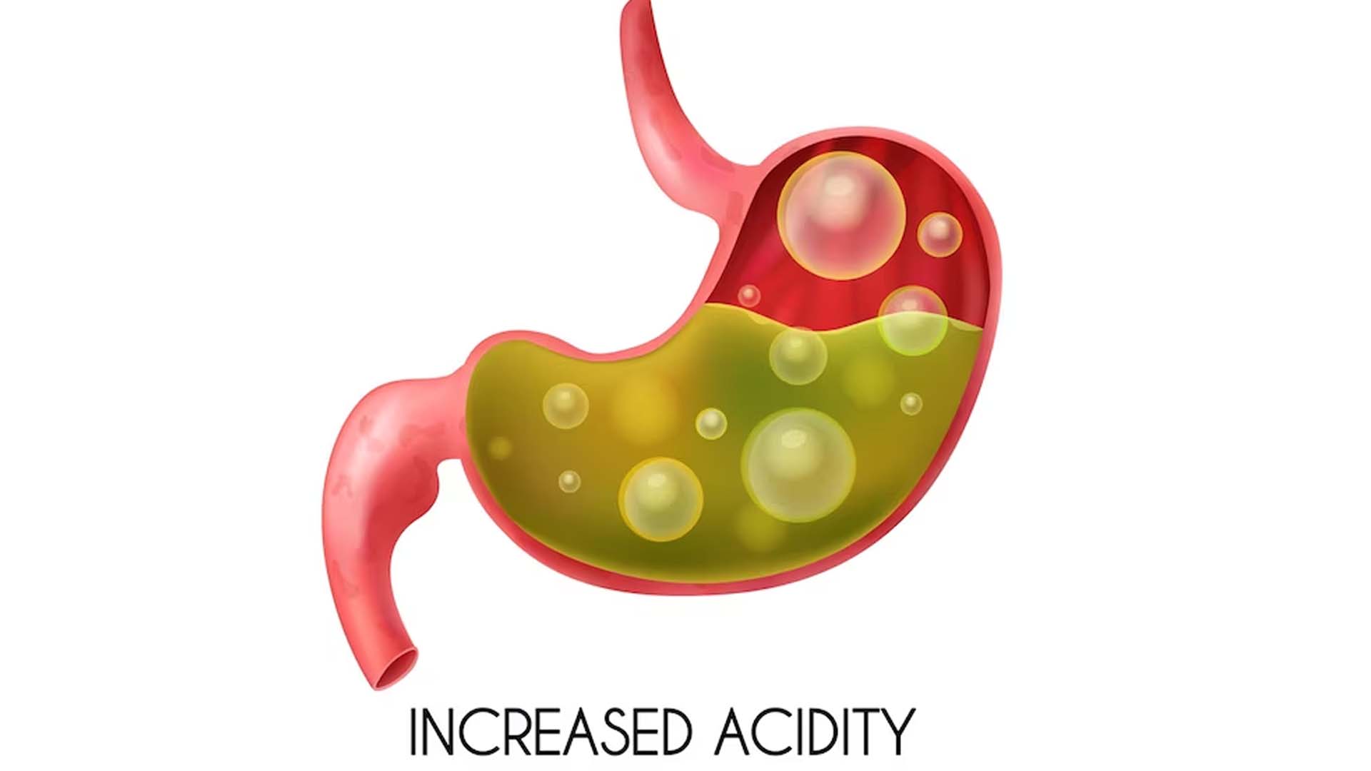 Does Acidity Cause Chest Pain?