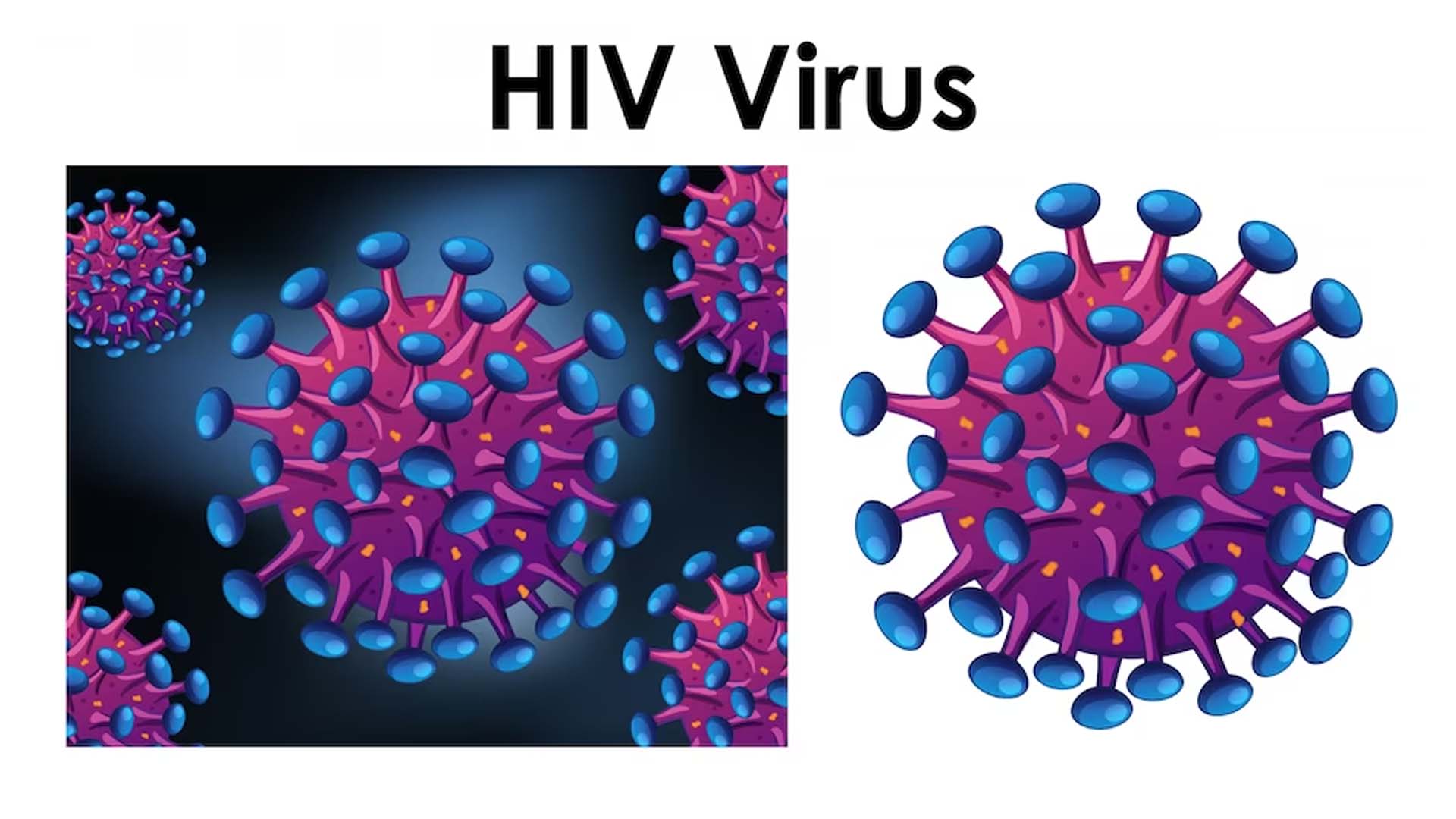 How is HIV Caused?
