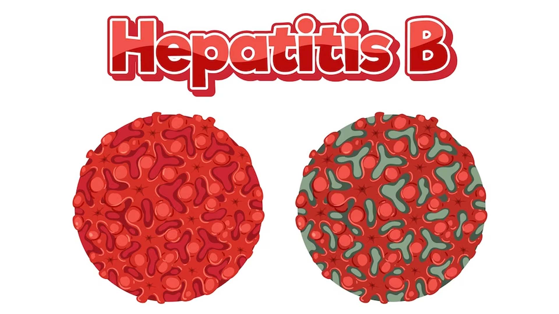 Causes of Hepatitis B?