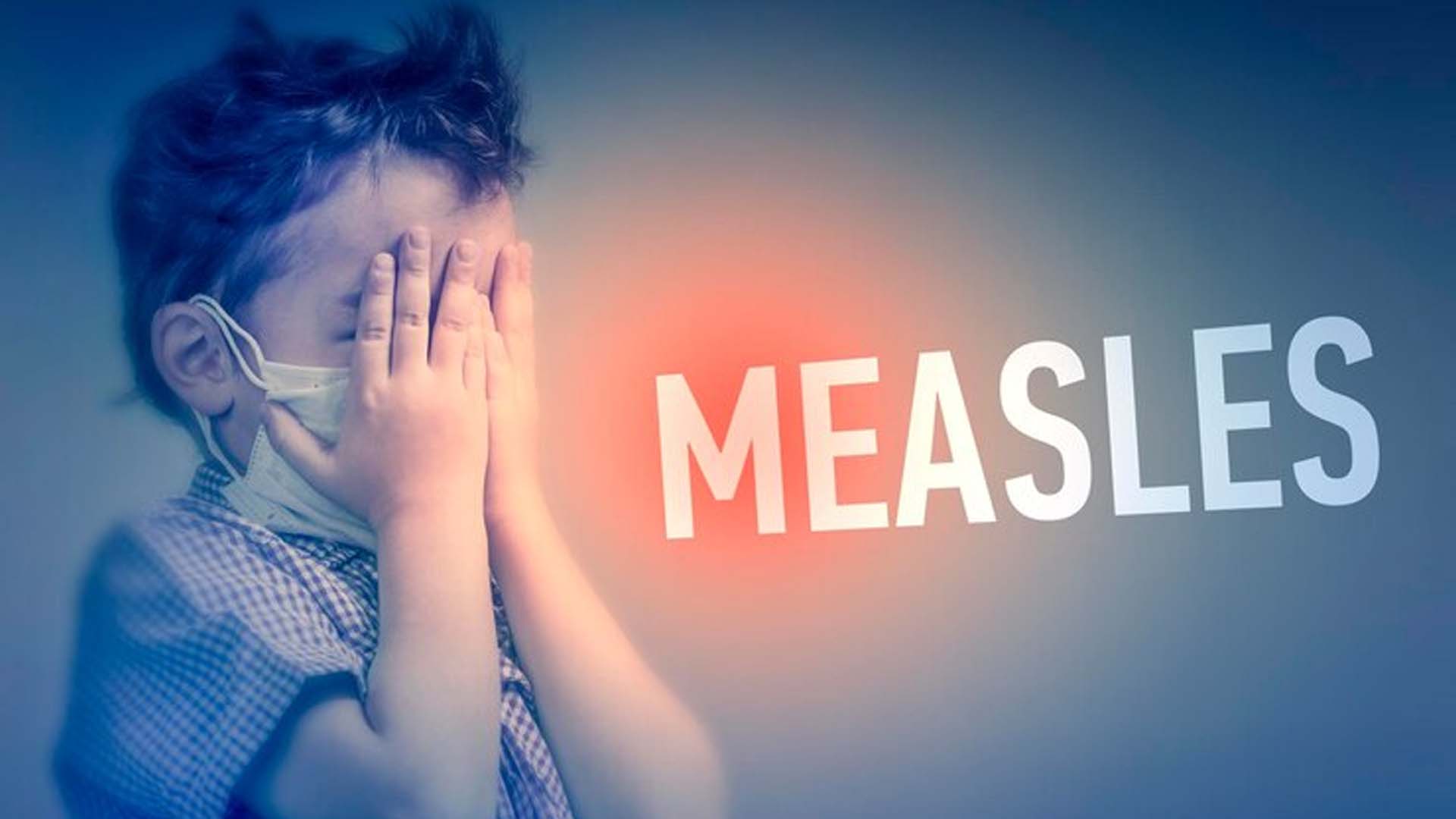 Causes of Measles