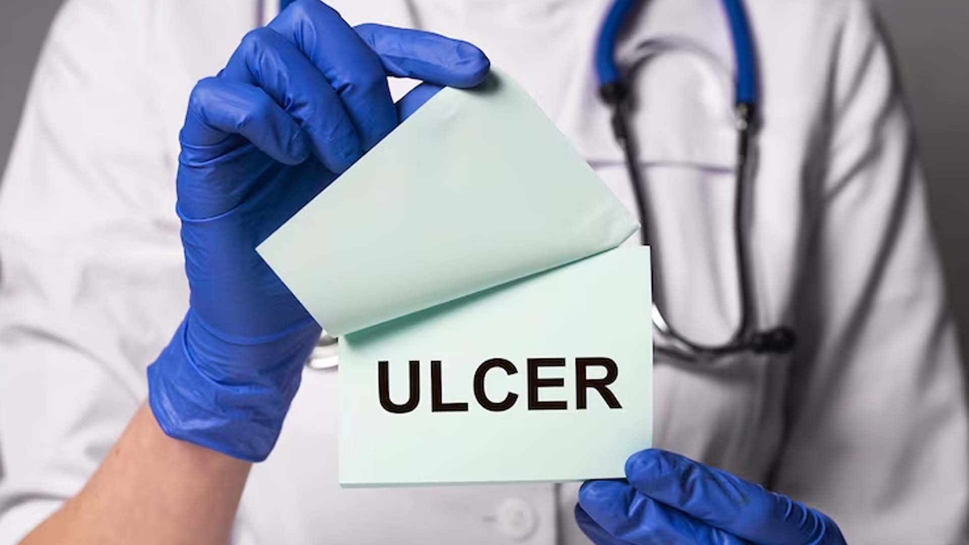 Causes of Ulcers