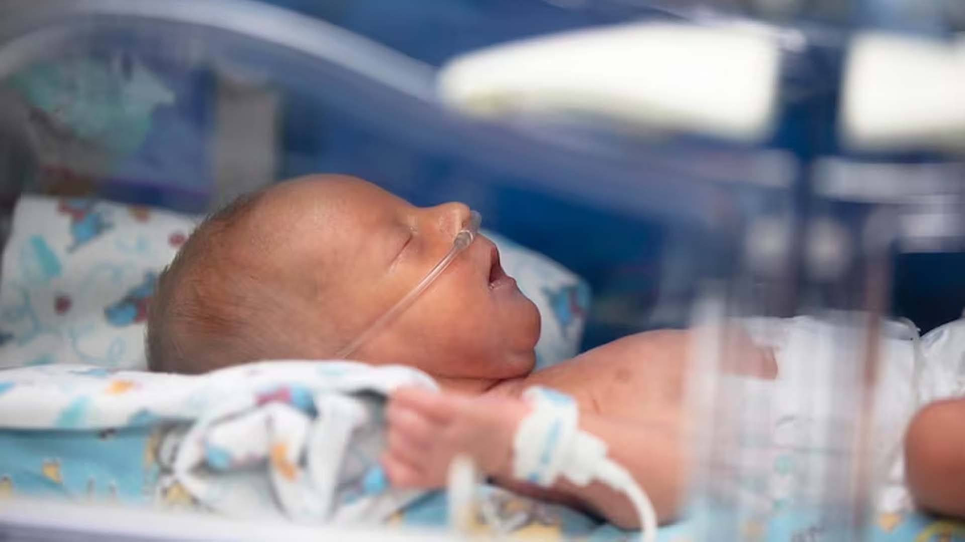 Breathing Problems in Newborn Babies