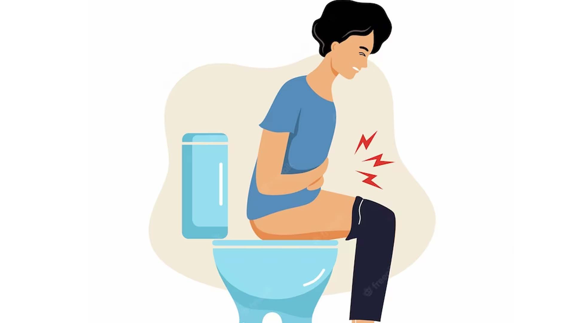 Constipation