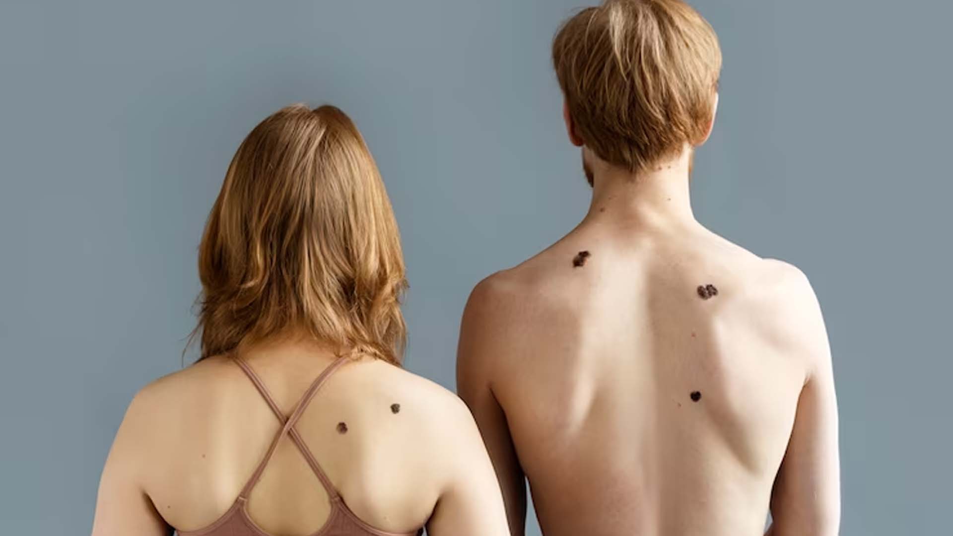 Moles