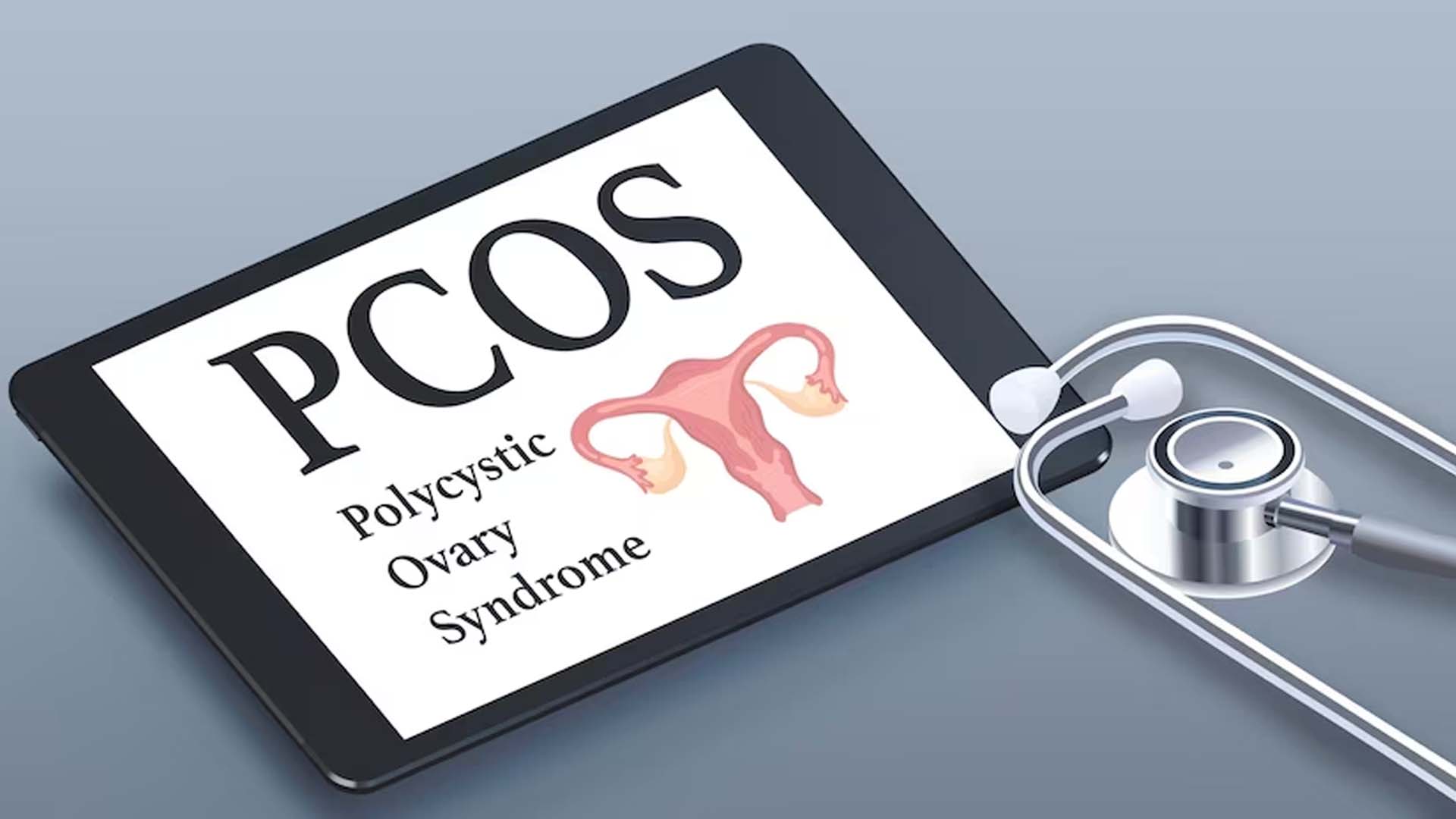 polycystic ovary syndrome (PCOS)
