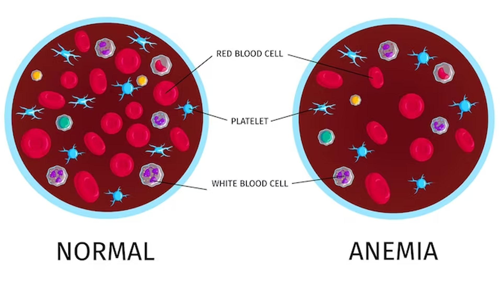 What are the Symptoms of Anemia in a Child?
