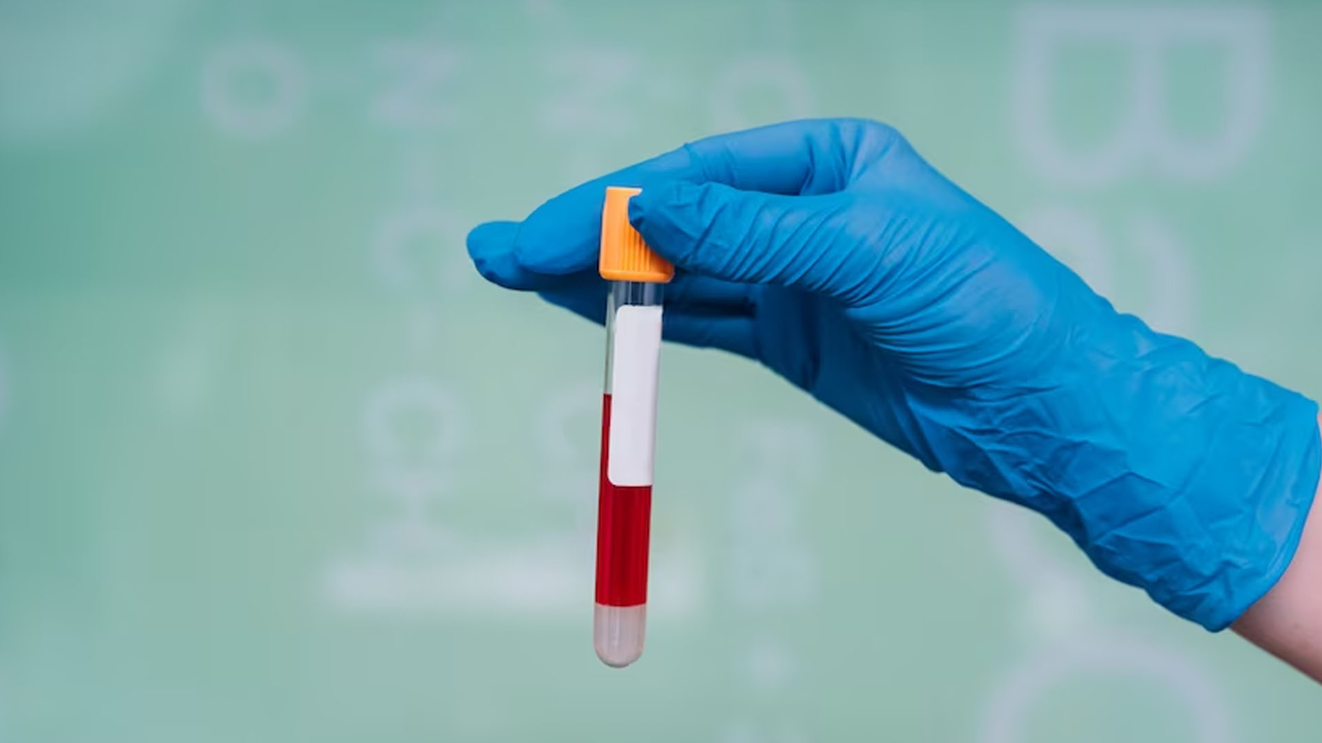 Is Blood in Urine a Symptom of Pregnancy?