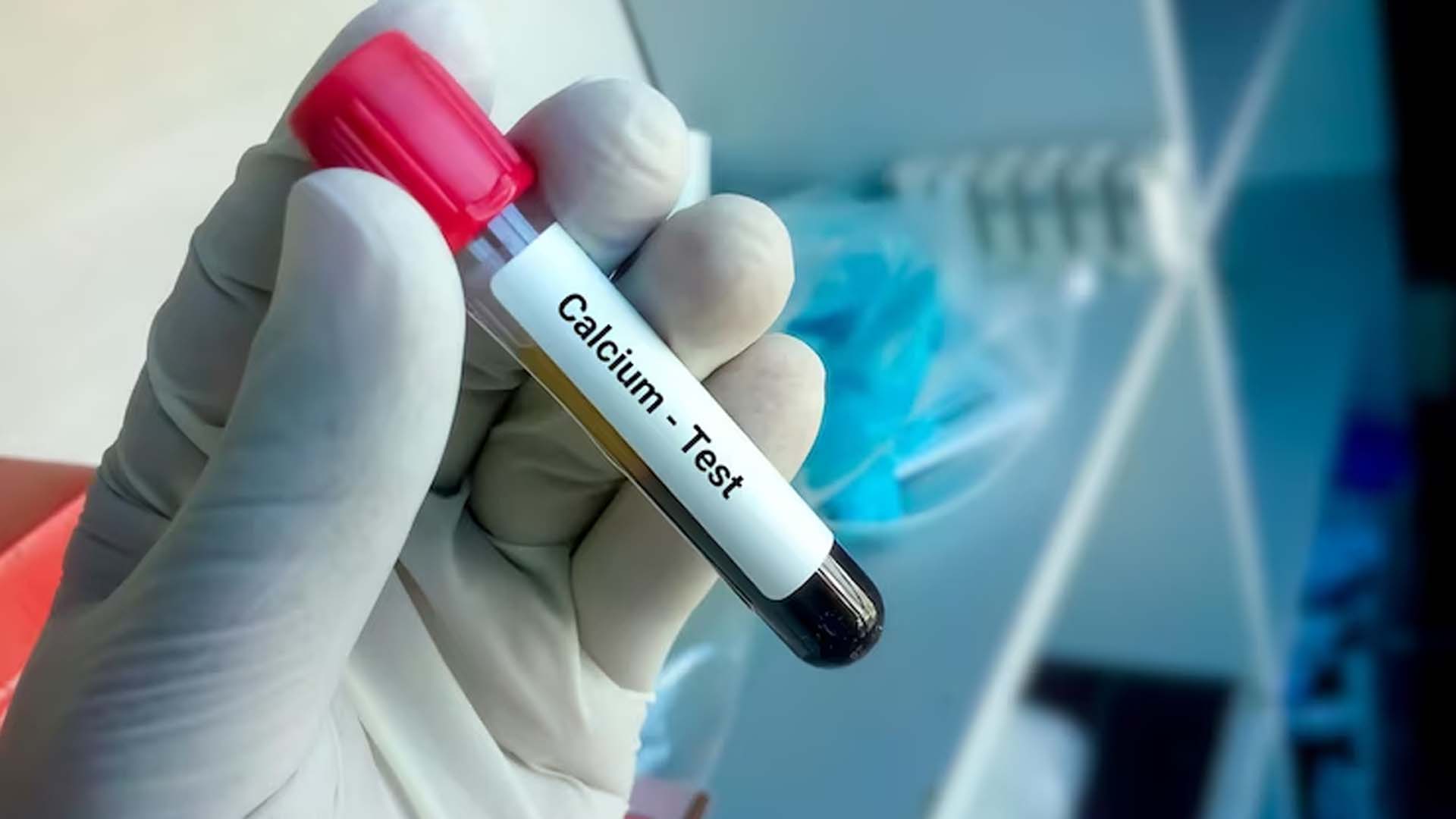 Calcium test