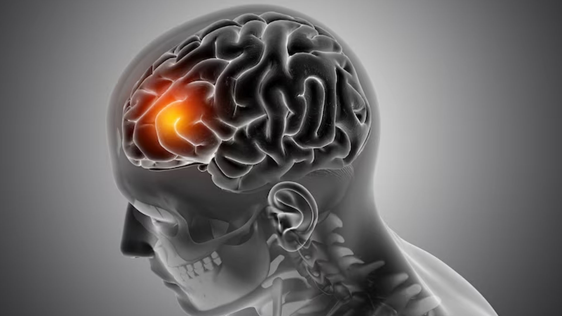 What are the Symptoms of Cerebral Edema?