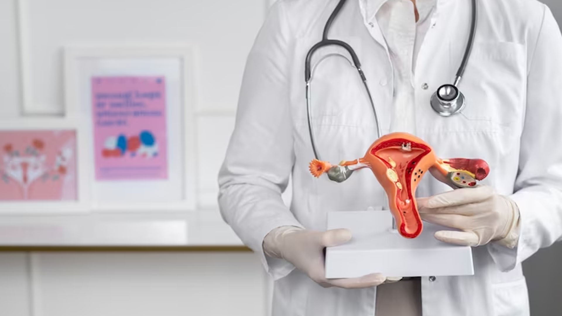 What are the Symptoms of Cervical Spondylosis?