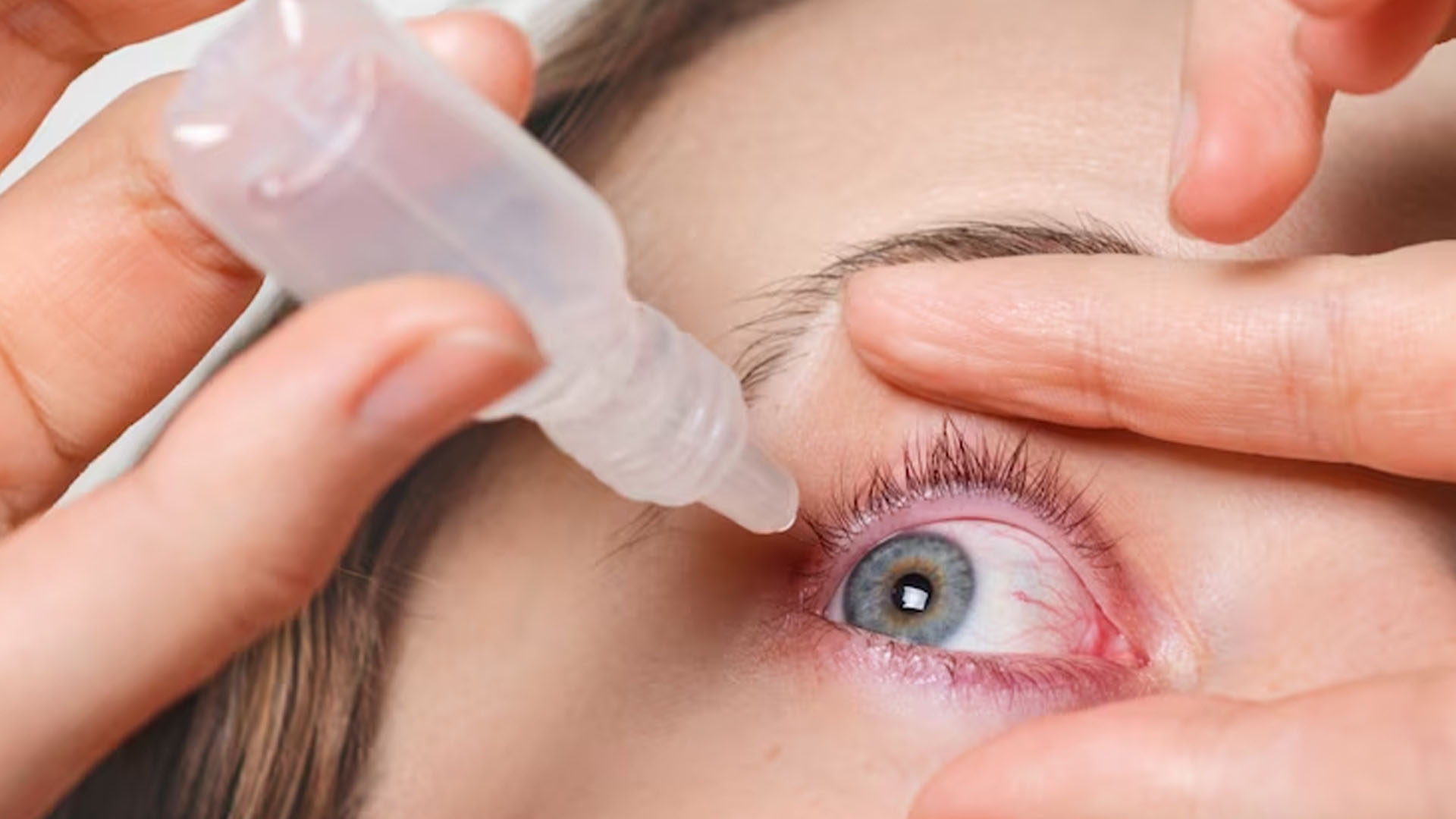 What are the Symptoms of Conjunctivitis?