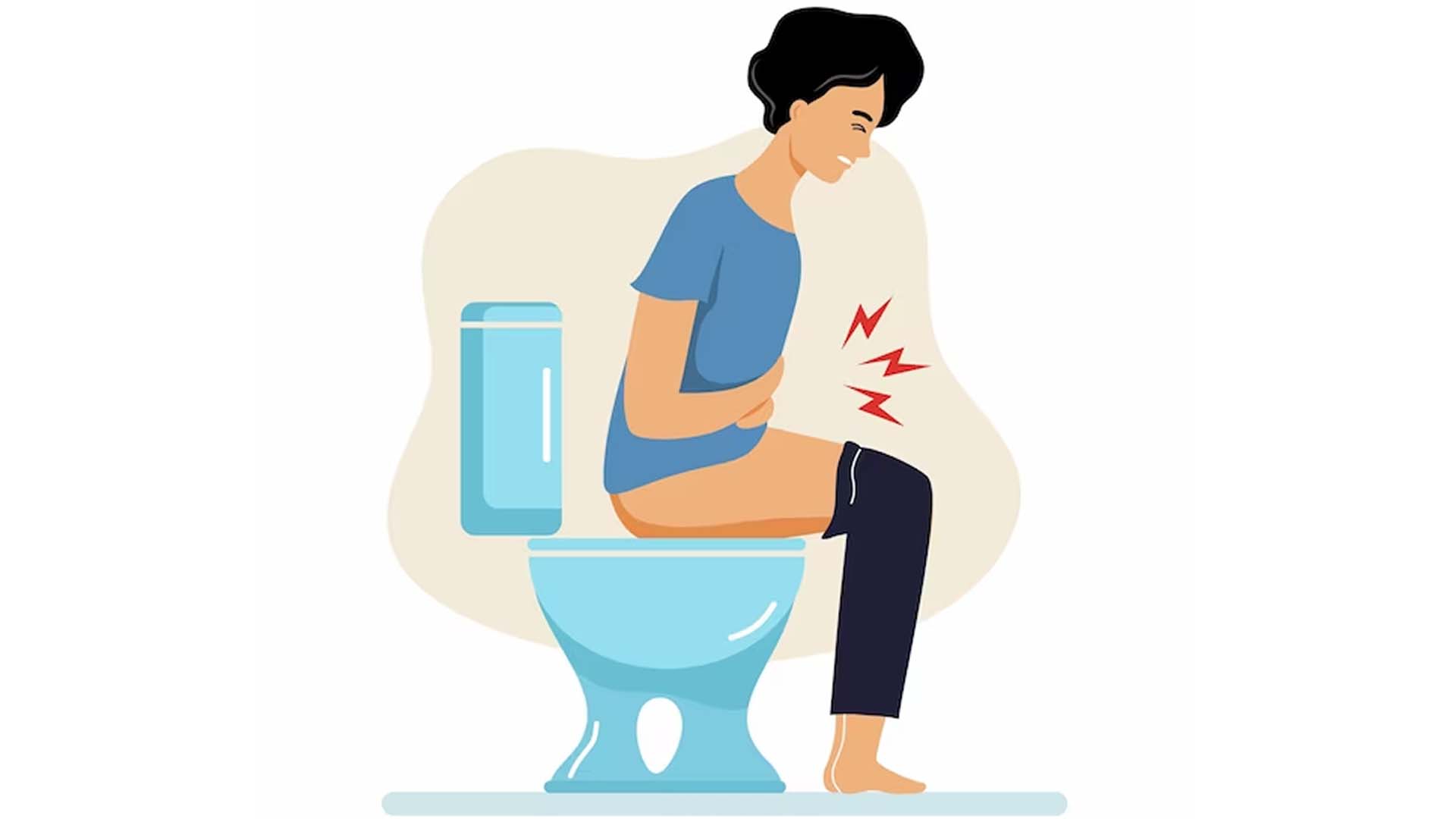 Constipation