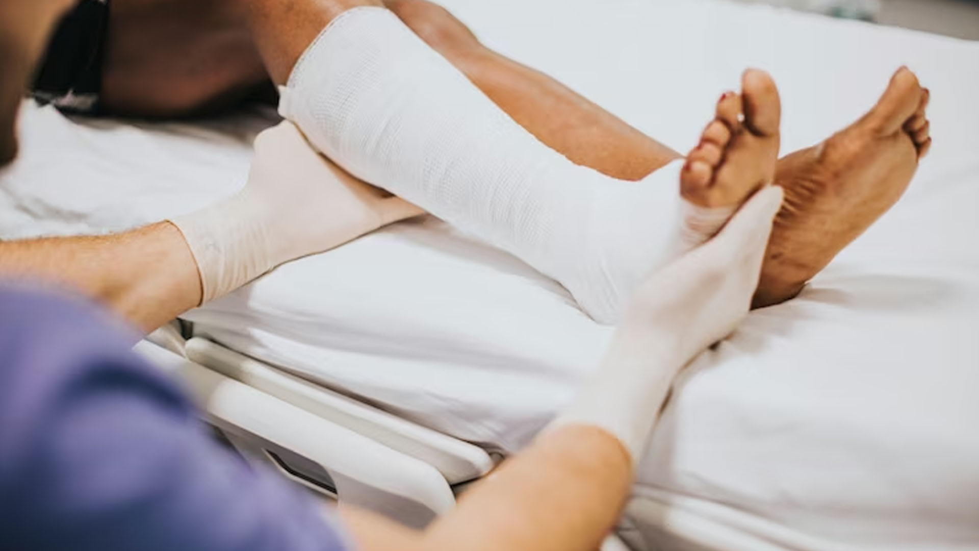 What are the Symptoms of Fracture?