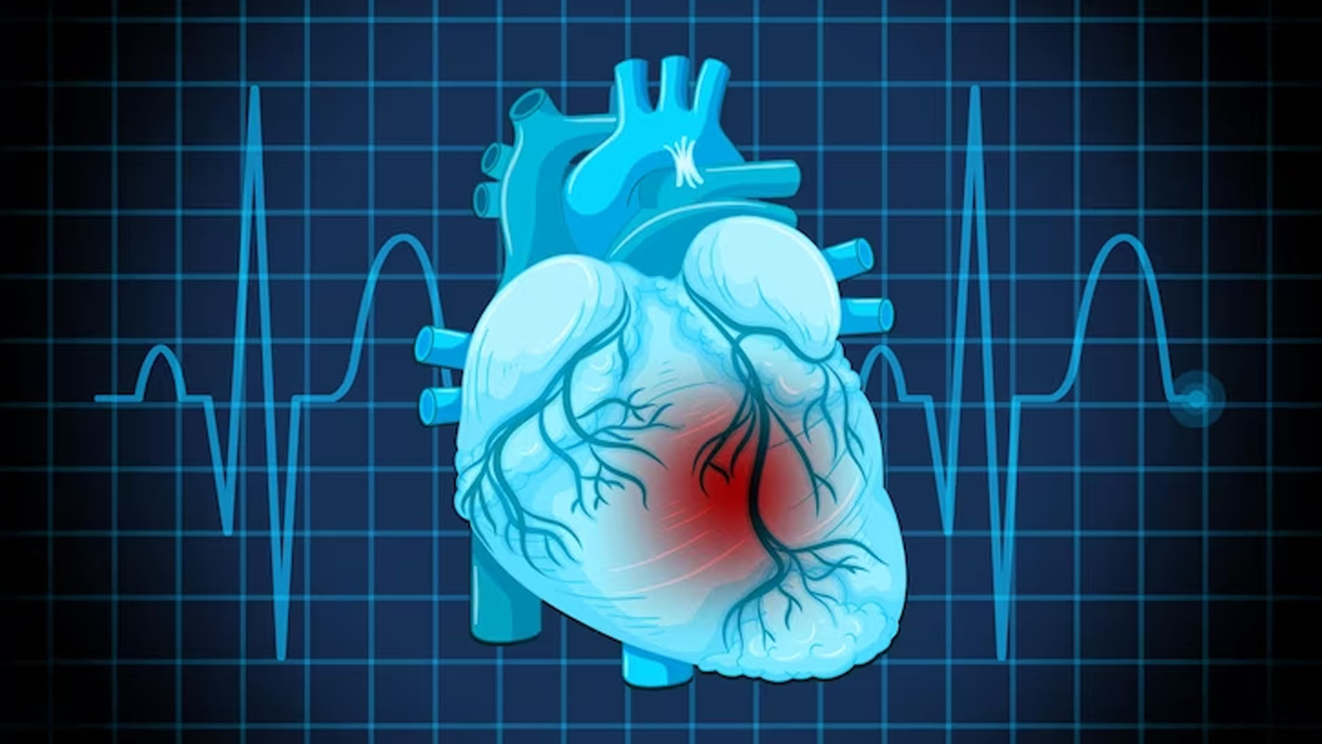 What are the Symptoms of Heart Blockage?