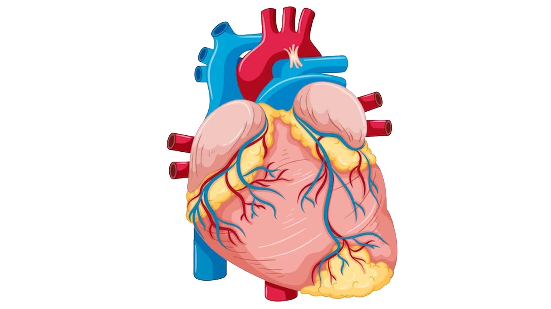 Cholesterol around Heart