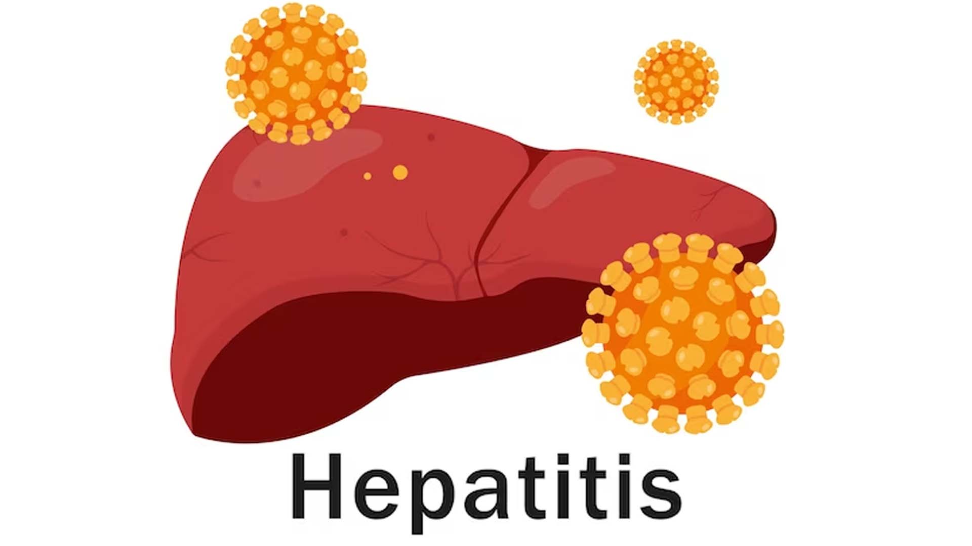Hepatitis Virus