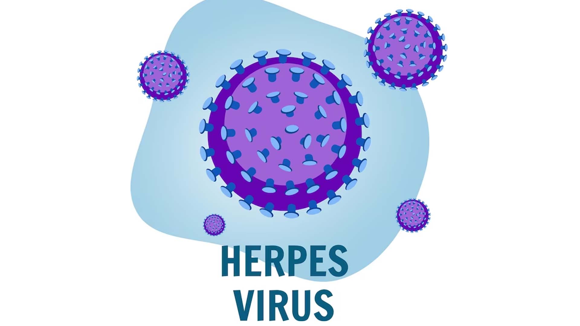 Herpes Illustration