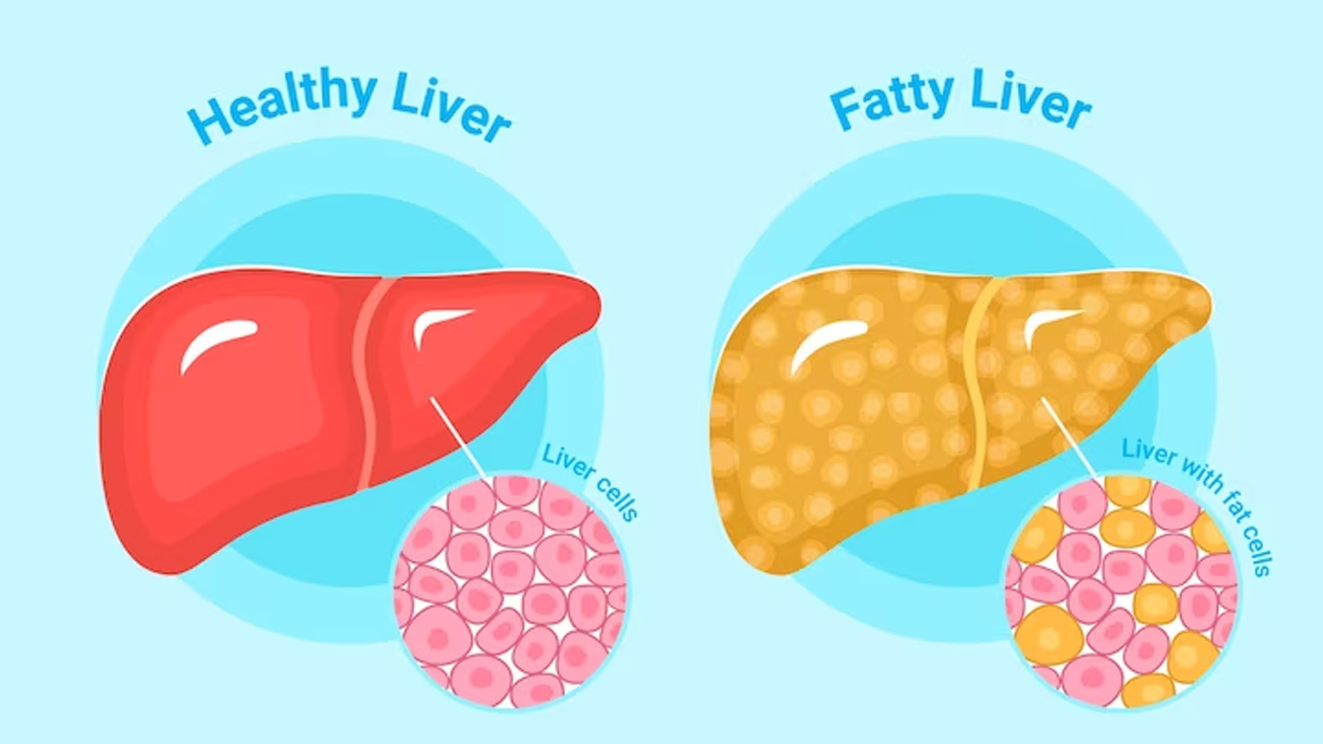What are the Symptoms of Liver Failure?