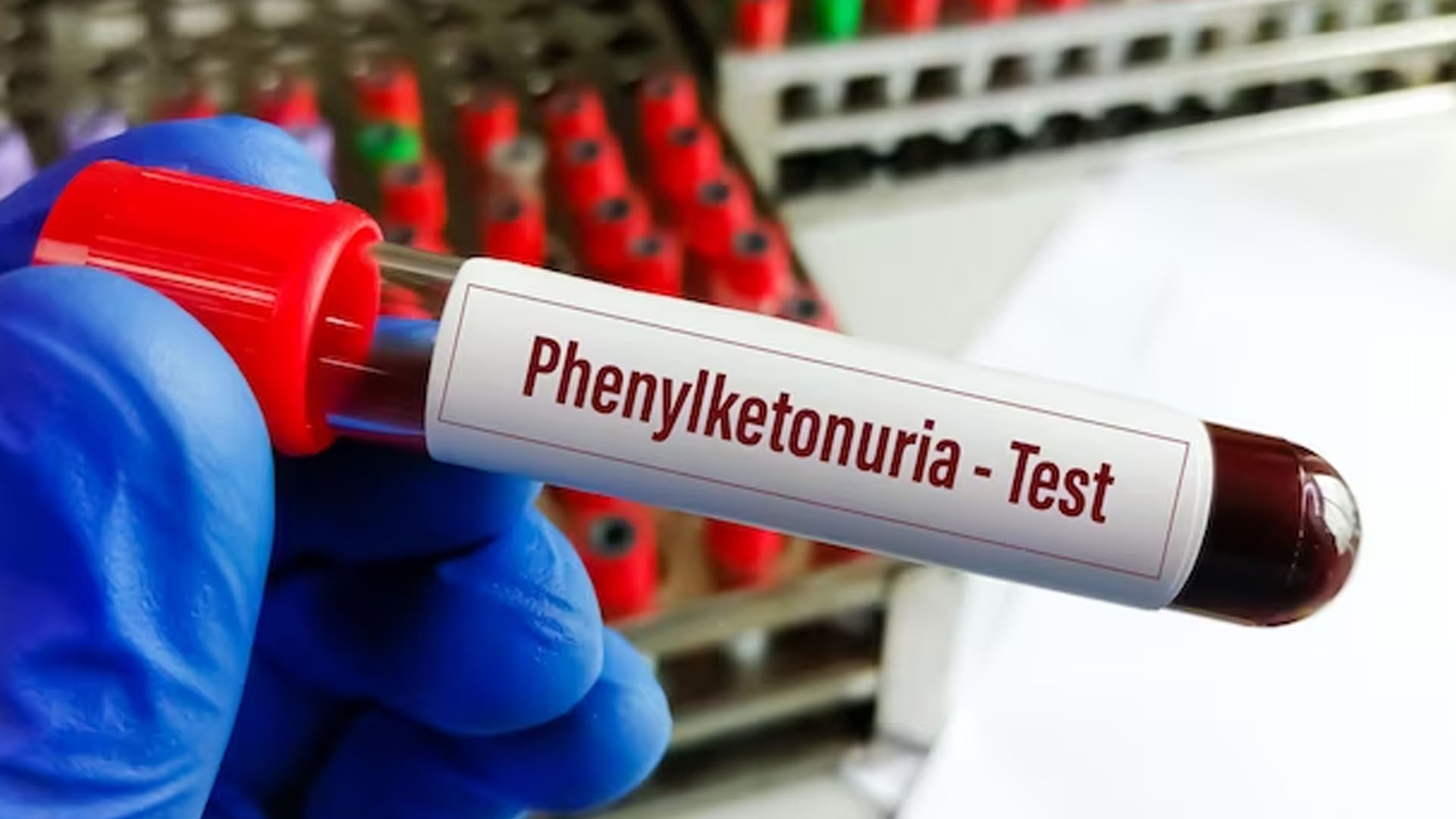 What are the Symptoms of Phenylketonuria?