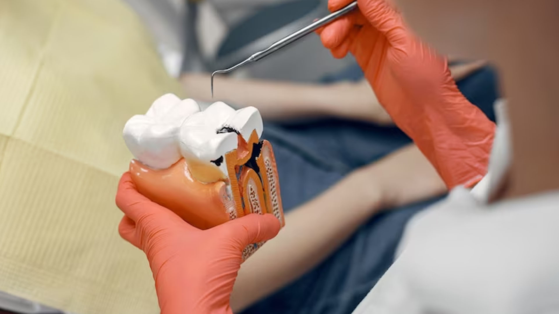 What are the Signs and Symptoms of Periodontal Disease?