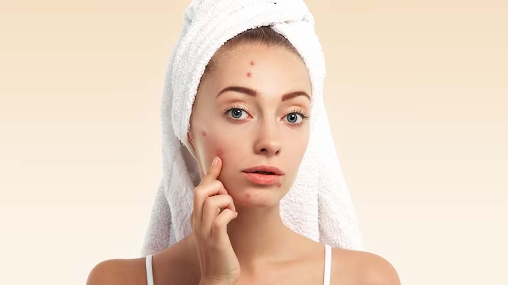 Pimple face