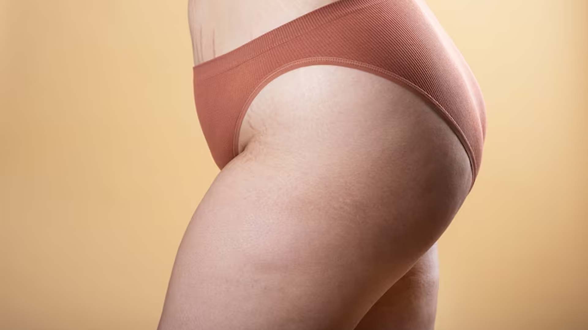 Thigh Fat
