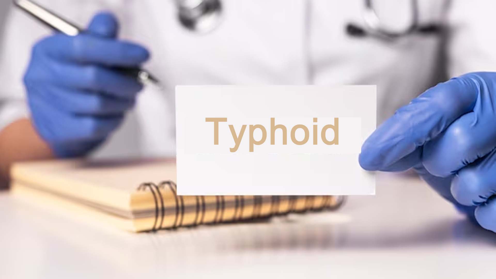 Typhoid fever