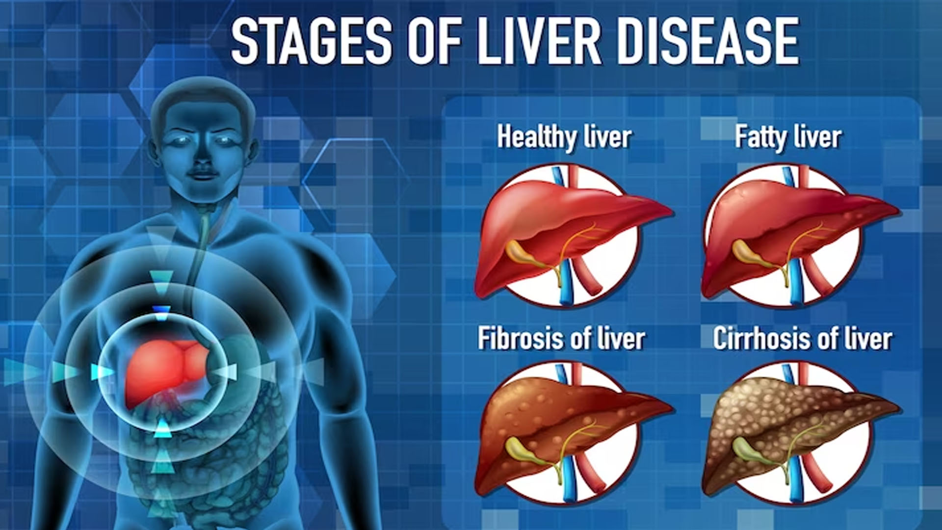 What are the Symptoms of PBC?