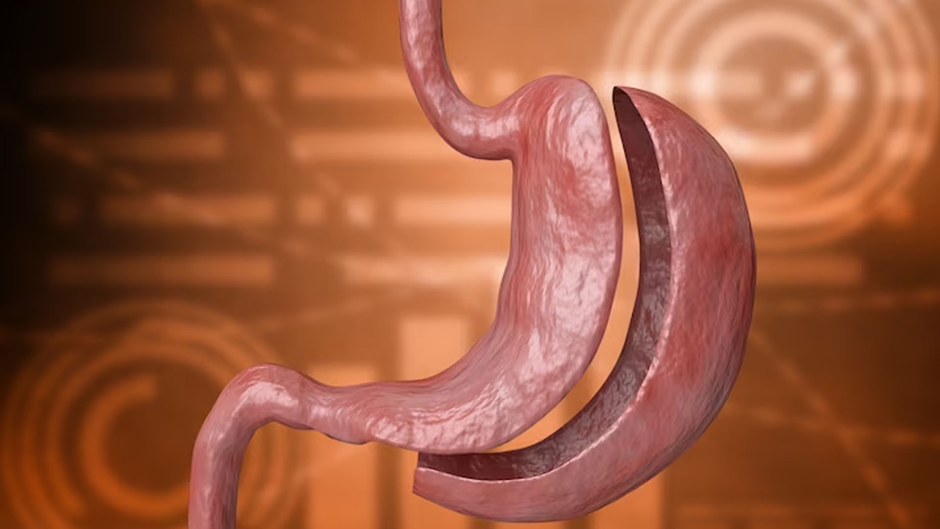 What are the Symptoms of Bile Duct Cancer?