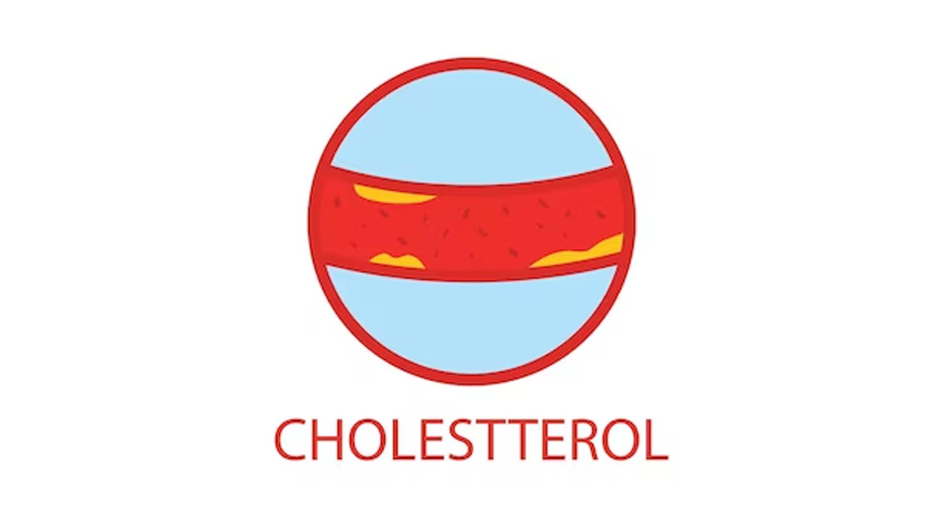 Cholesterol