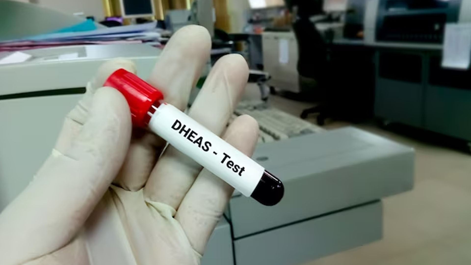 What are the Symptoms of Low DHEA (Dehydroepiandrosterone)?