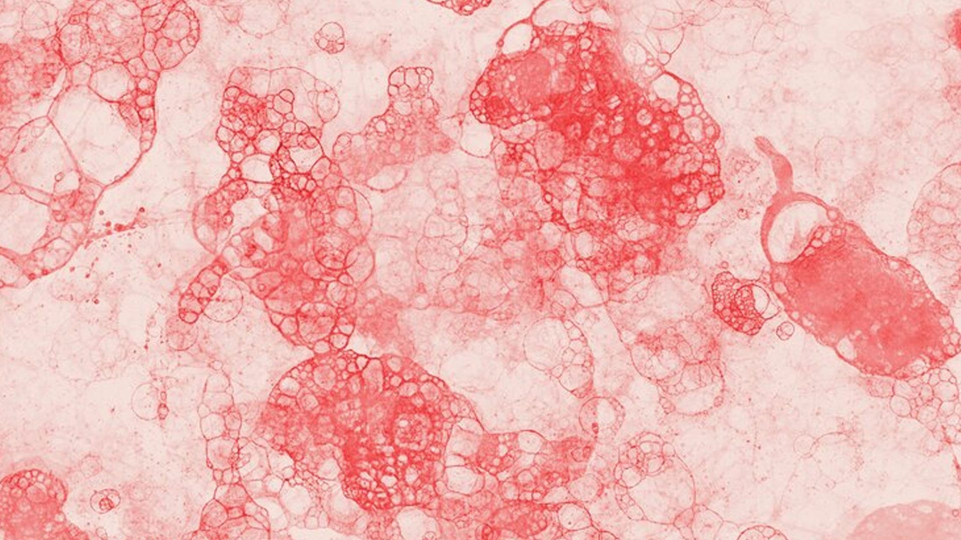 What are the Symptoms of Decreasing Platelets?
