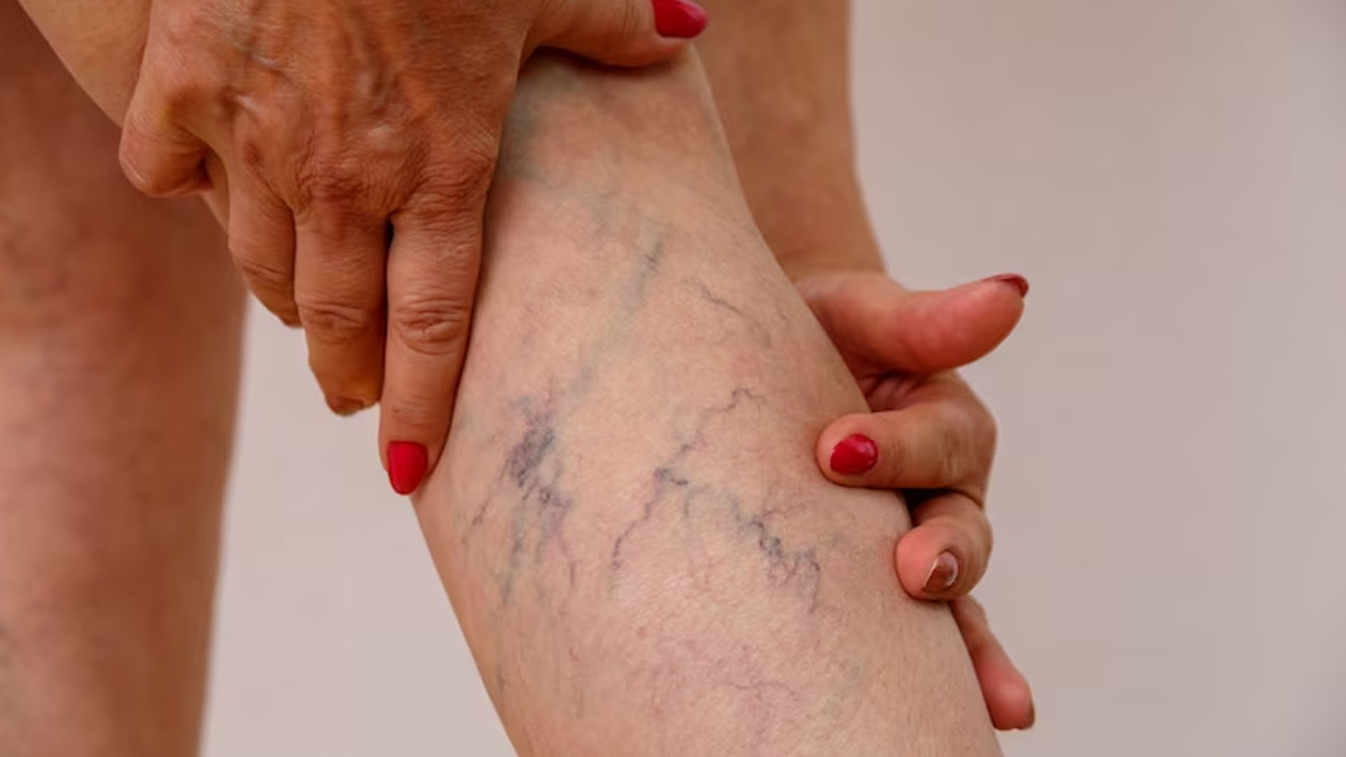 What are the Symptoms of Deep Vein Thrombosis?