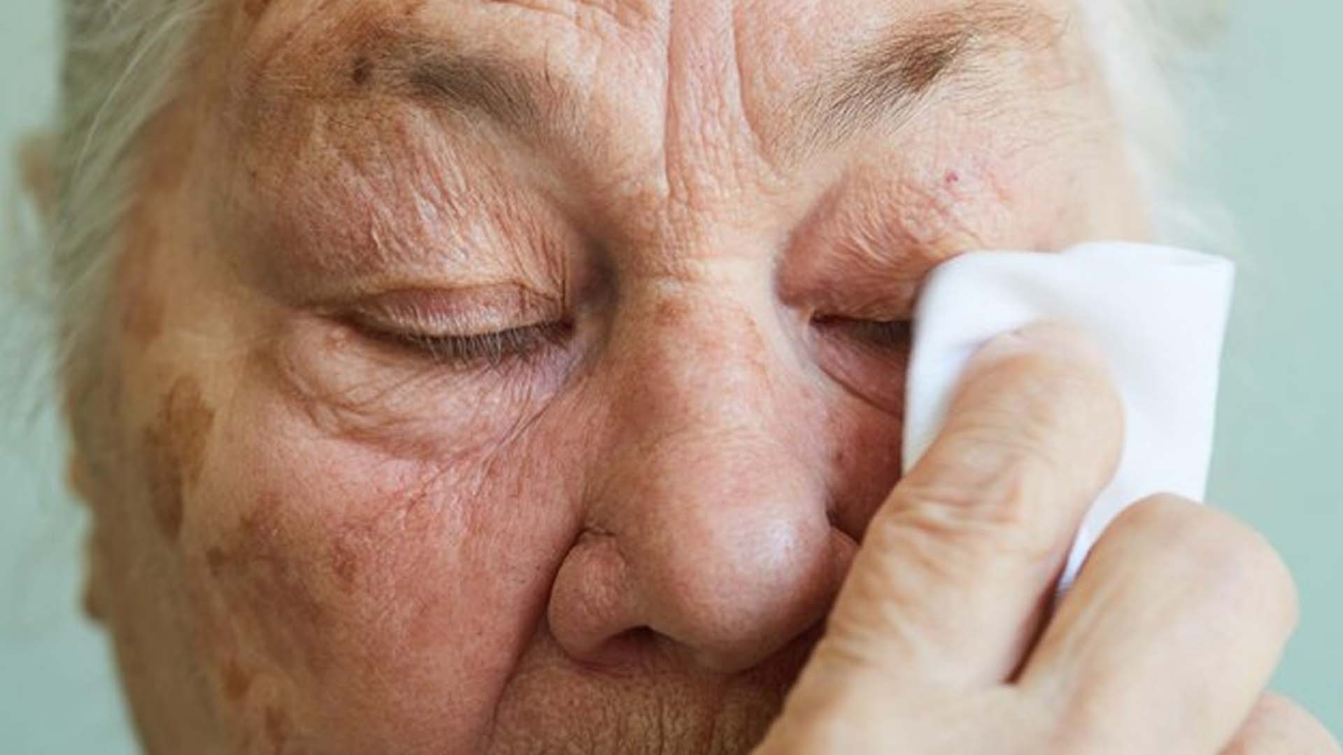 Watery Eyes in the Elderly