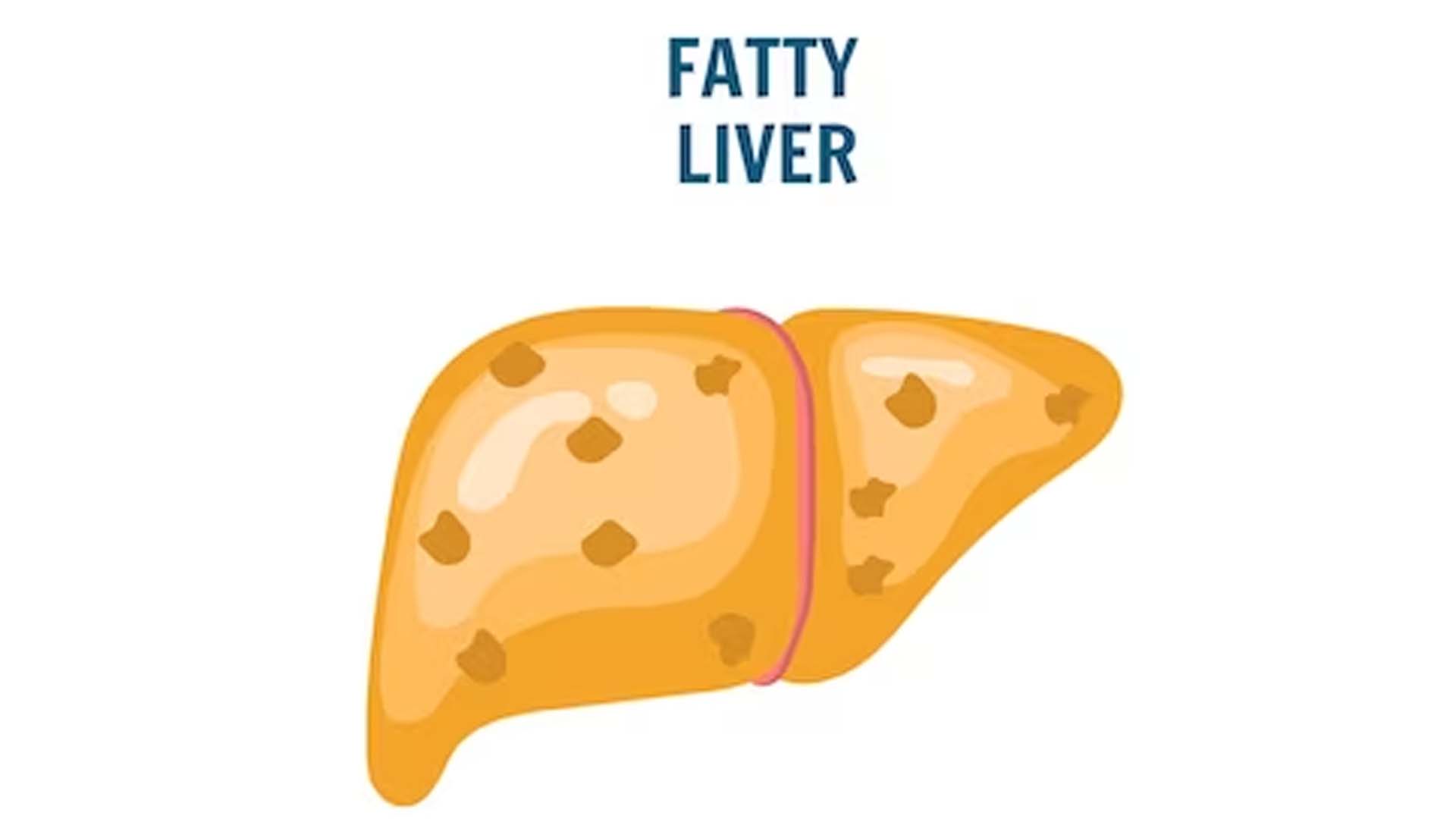 Unhealthy fatty liver in vector illustration
