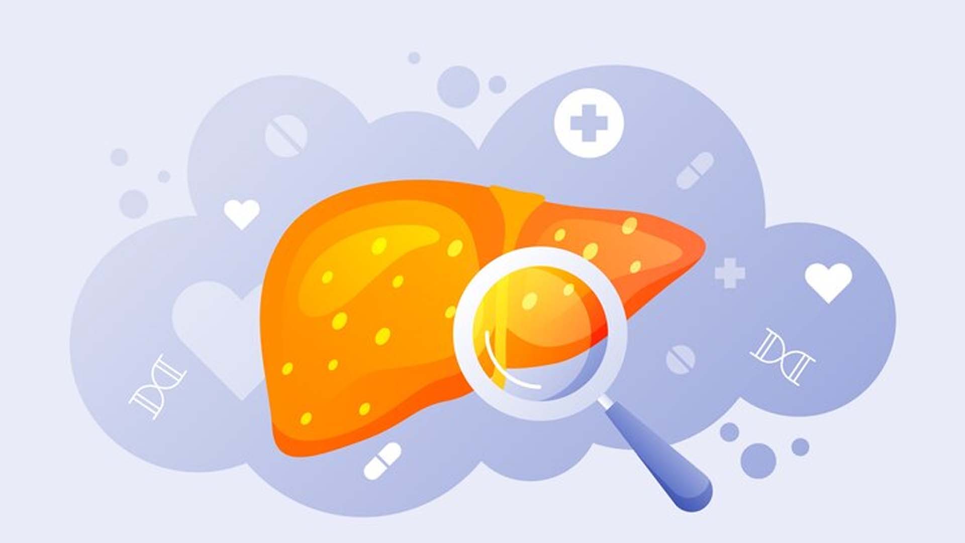 Fatty liver Illustration