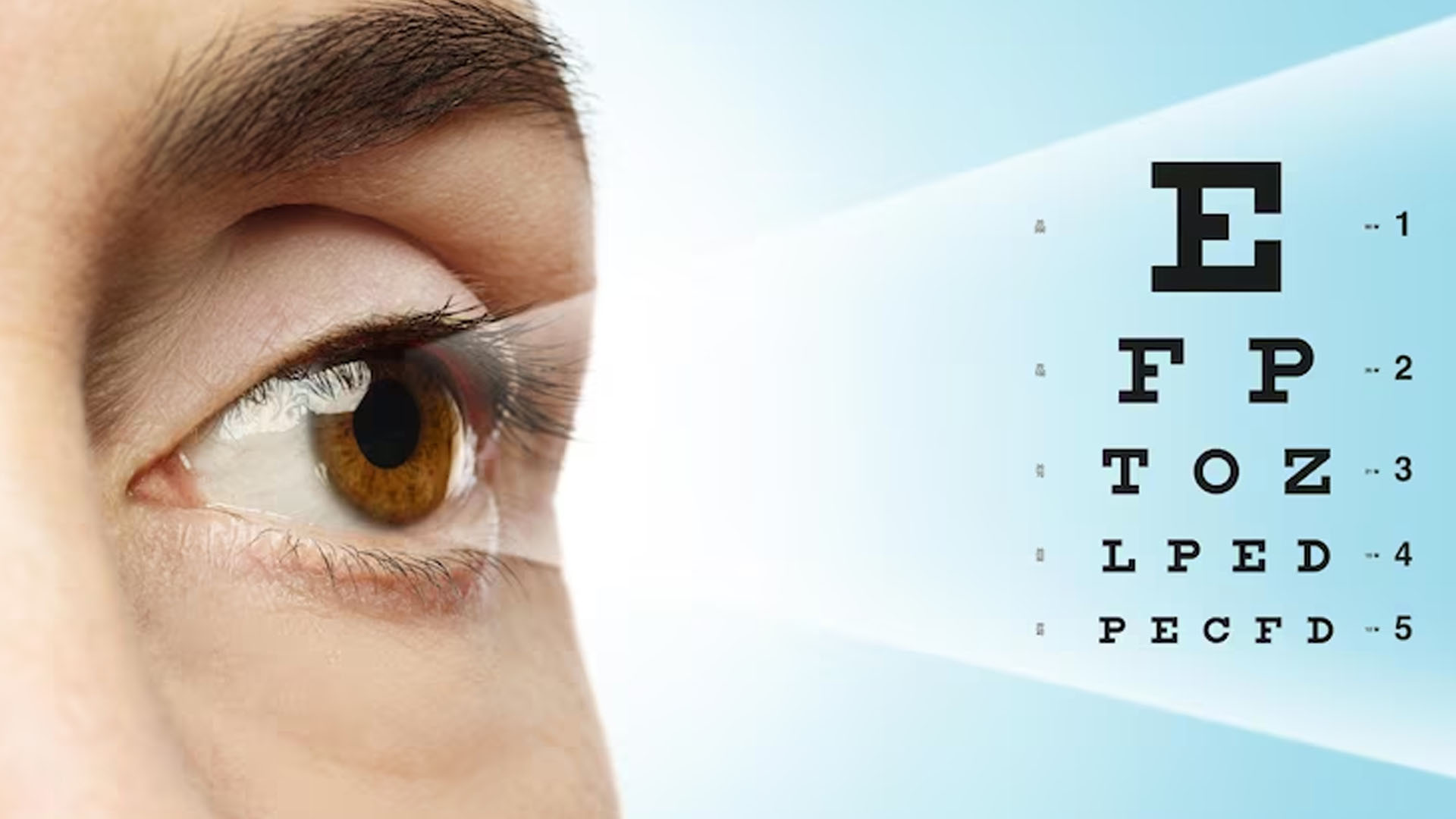 What are the Symptoms of Narrow Angle Glaucoma?