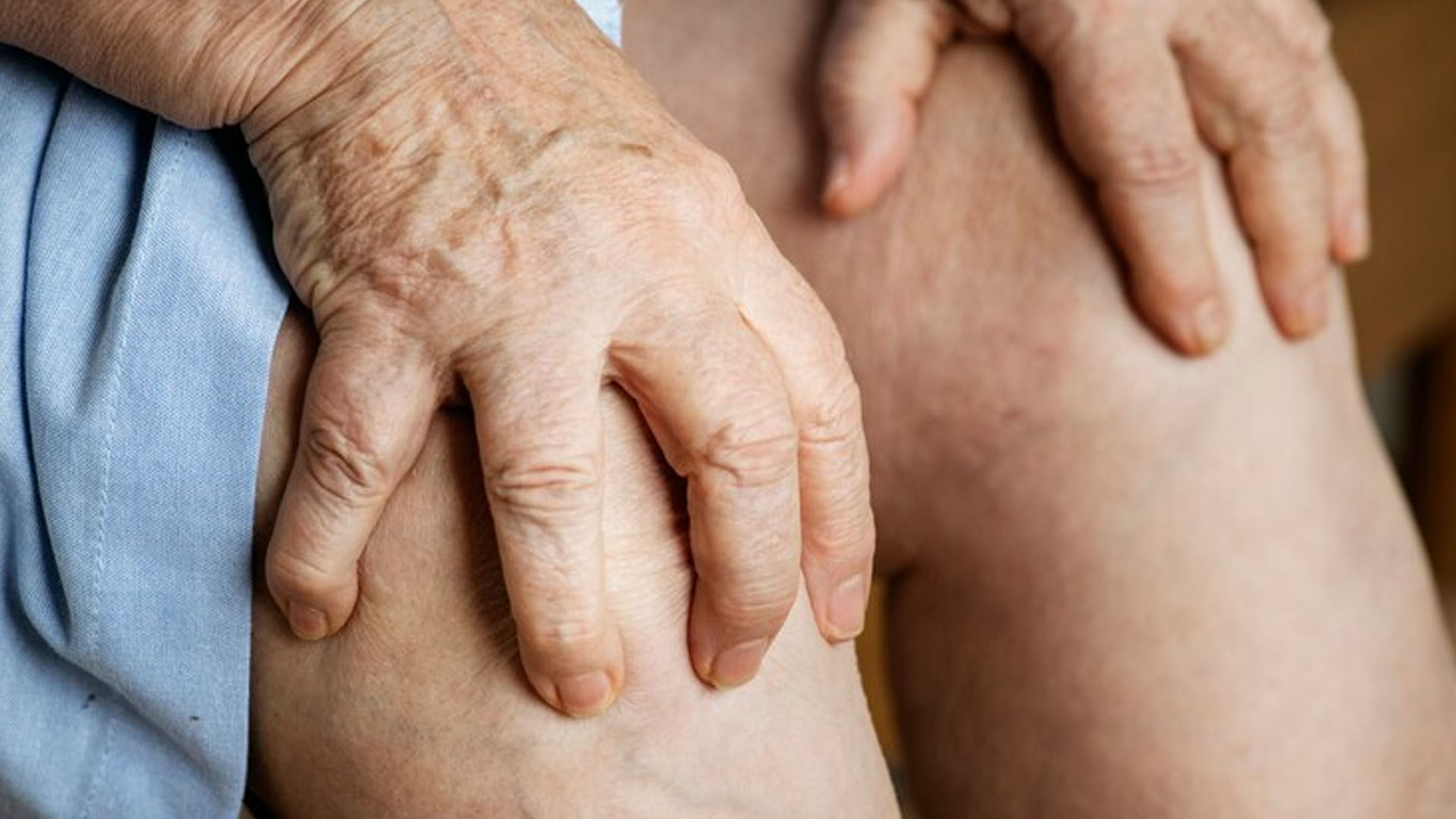 What is Gout and its Symptoms?