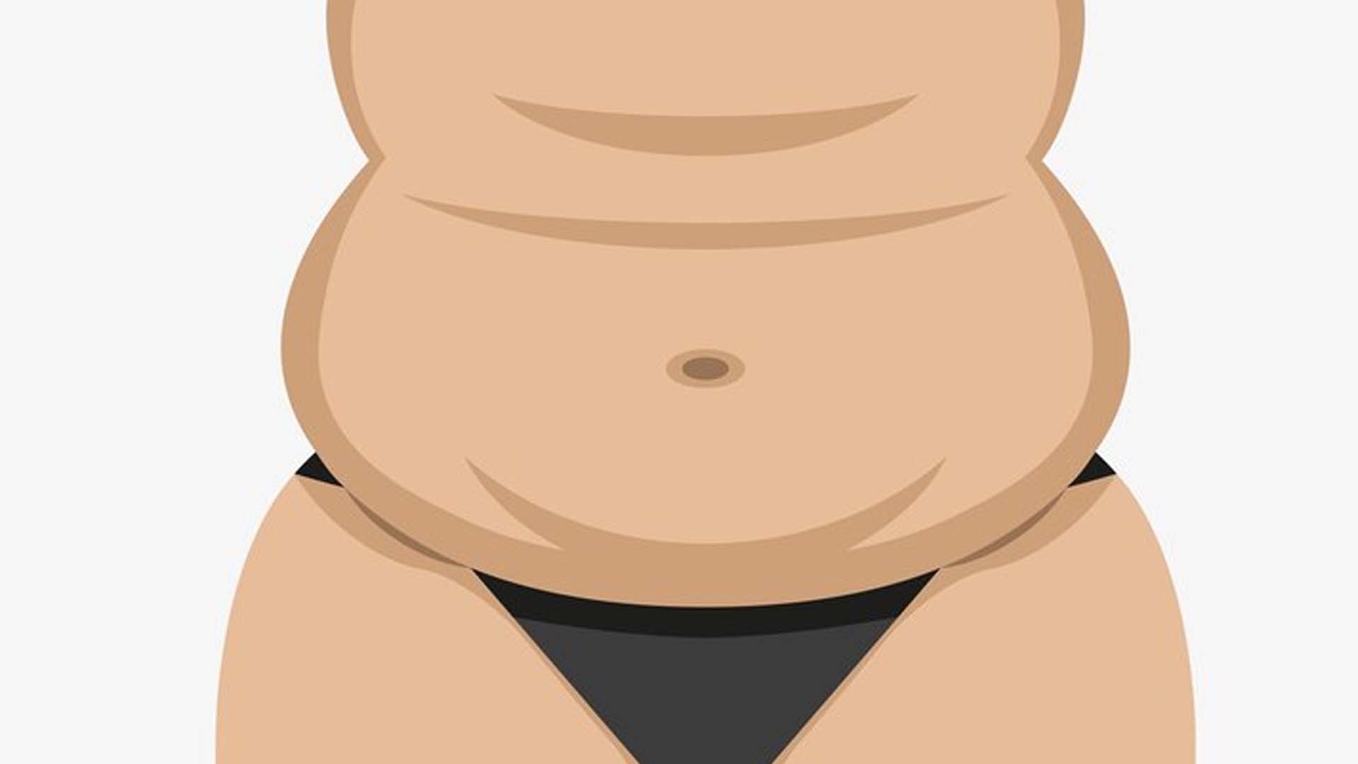 Hanging Belly Fat
