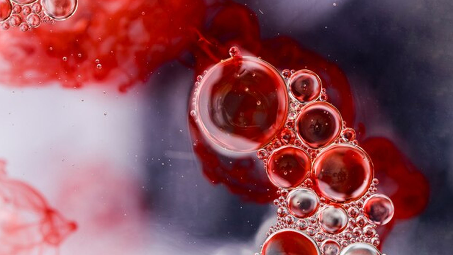 What are the Symptoms of Hemophilia B?