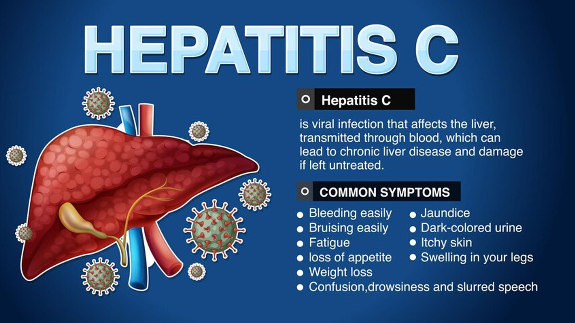 When do Hepatitis C Symptoms Appear?