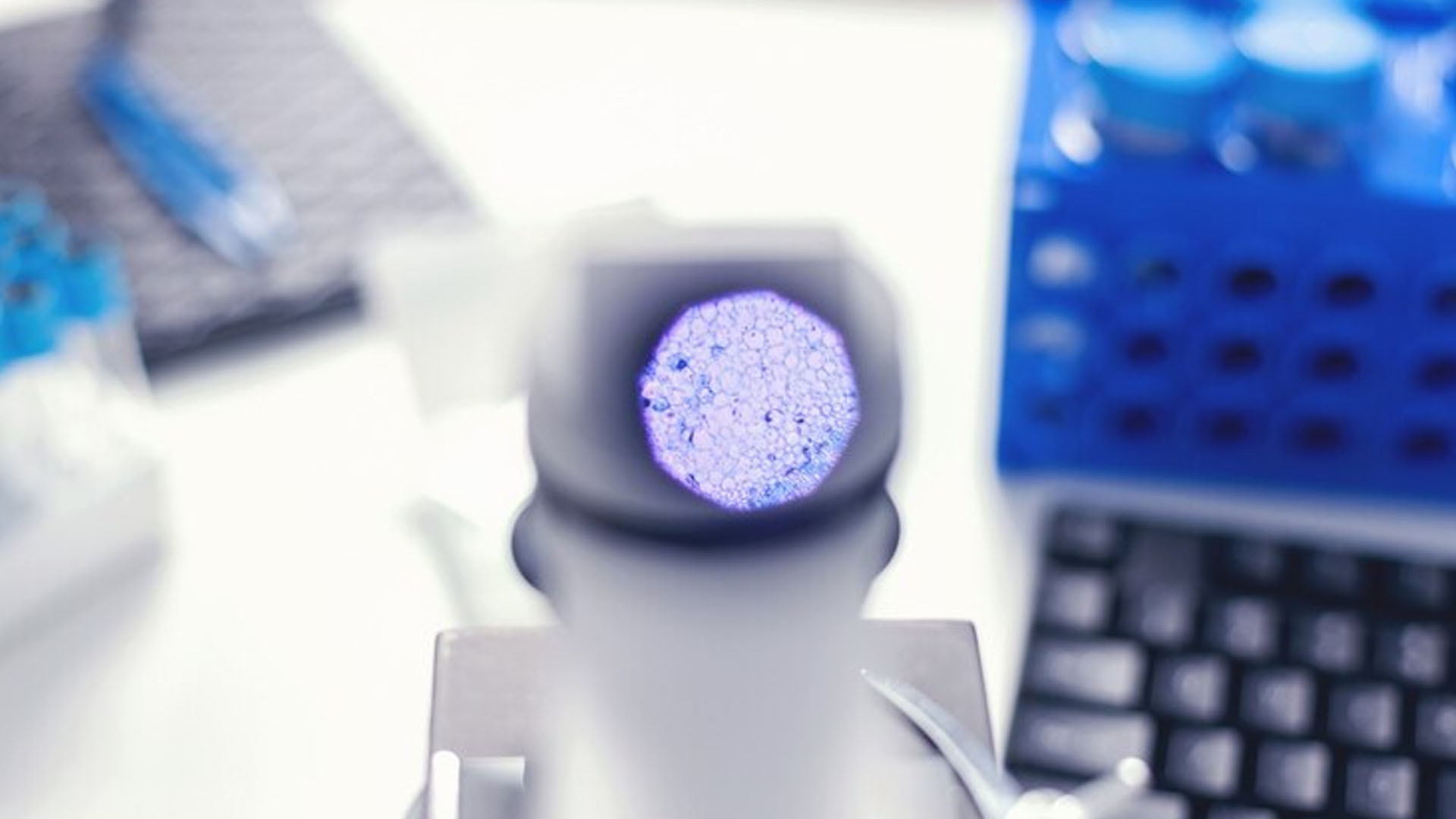 What are the Symptoms of Leukopenia?