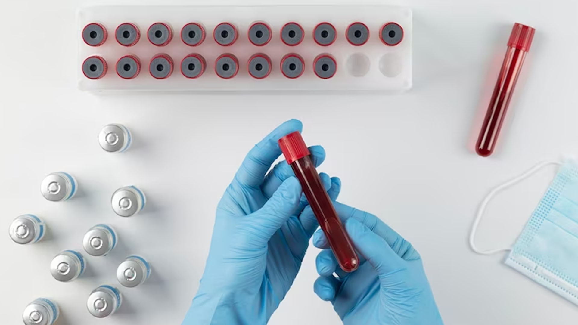 What are the Symptoms of Low Blood Platelet Count?
